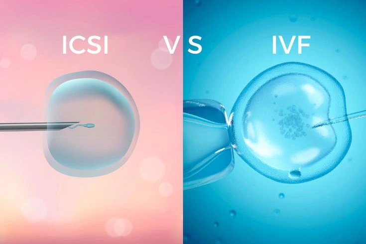 IVF vs ICSI: What Does It Really Matter for an Embryologist?